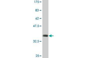 Western Blot detection against Immunogen (36. (ABCC2 antibody  (AA 214-313))