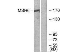 Western blot analysis of extracts from HuvEc cells, using MSH6 Antibody. (MSH6 antibody  (AA 341-390))
