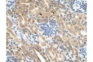 Image no. 1 for anti-Indian Hedgehog (IHH) (AA 24-73) antibody (ABIN205075) (Indian Hedgehog antibody  (AA 24-73))