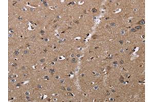 The image on the left is immunohistochemistry of paraffin-embedded Human brain tissue using ABIN7128954(CLDN23 Antibody) at dilution 1/30, on the right is treated with fusion protein.