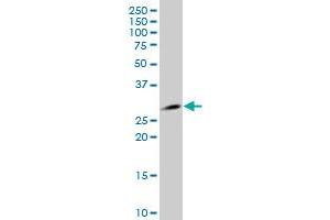 RIT1 polyclonal antibody (A01), Lot # 050914JC01 Western Blot analysis of RIT1 expression in HepG2 . (RIT1 antibody  (AA 120-217))