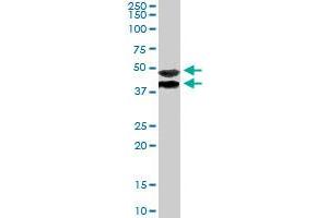 TRIM54 polyclonal antibody  staining (1ug/ml) of human muscle lysate (RIPA buffer, 35ug total protein per lane) .