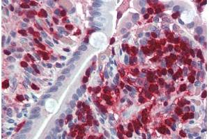 Human Small Intestine (formalin-fixed, paraffin-embedded) stained with S100A4 antibody ABIN337109 at 2. (s100a4 antibody  (AA 86-98))