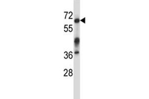 Irak3 antibody western blot analysis in mouse kidney tissue lysate. (IRAK3 antibody  (AA 517-544))
