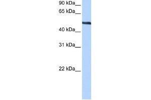 WB Suggested Anti-TRIP6 Antibody Titration:  0. (TRIP6 antibody  (Middle Region))