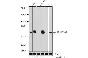 Western blot analysis of extracts of various cell lines, using Phospho-CDK2-T160 antibody (ABIN3020138, ABIN3020139, ABIN3020140, ABIN1681460 and ABIN1681461) at 1:1000 dilution. (CDK2 antibody  (pThr160))