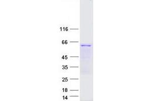 Validation with Western Blot (TCP11 Protein (Transcript Variant 1) (Myc-DYKDDDDK Tag))