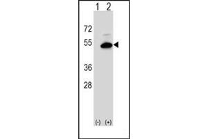 Western blot analysis of SGMS2 (arrow) using SGMS2 Antibody (C-term) Cat. (Sphingomyelin Synthase 2 antibody  (C-Term))