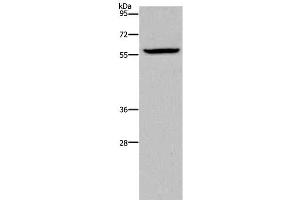 Western Blot analysis of Human fetal brain tissue using KDM4D Polyclonal Antibody at dilution of 1:1100 (JMJD2D antibody)
