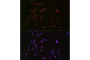 Immunofluorescence analysis of C6 cells using L Rabbit mAb (ABIN7270266) at dilution of 1:100 (40x lens). (ASH2L antibody)