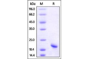 Biotinylated Human TNF-alpha (HPLC-verified) on SDS-PAGE under reducing (R) condition. (TNF alpha Protein (AA 77-233) (His tag,AVI tag,Biotin))