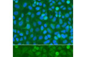 Immunofluorescence analysis of A549 cells using NCK1 Polyclonal Antibody (NCK1 antibody)