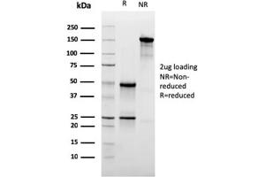 SDS-PAGE Analysis Purified CD47 Mouse Monoclonal Antibody (IAP/3019). (CD47 antibody  (AA 18-135))
