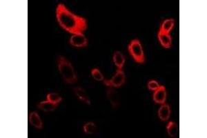 Immunofluorescent analysis of mPR gamma staining in LOVO cells. (PAQR5 antibody  (C-Term))