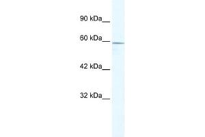 WB Suggested Anti-ZBTB7C Antibody Titration:  5. (ZBTB7C antibody  (N-Term))