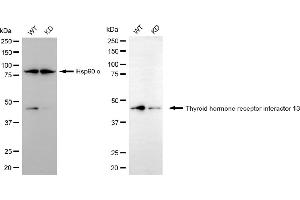 Western blotting analysis using thyroid hormone receptor interactor 13 antibody (ABIN7800555).
