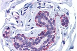 Human Breast: Formalin-Fixed, Paraffin-Embedded (FFPE) (FREM2 antibody  (Internal Region))