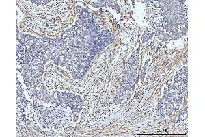 IHC analysis of FHL2 using anti-FHL2 antibody (ABIN7600782). (FHL2 antibody  (AA 234-279))