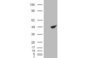 HEK293 overexpressing BHMT (ABIN5422884) and probed with ABIN334358 (mock transfection in first lane).