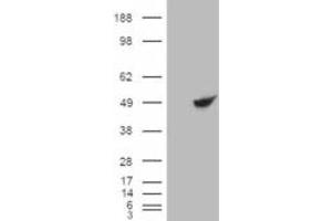 HEK293 overexpressing BHMT (ABIN5422884) and probed with ABIN334358 (mock transfection in first lane). (BHMT antibody  (C-Term))