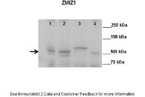 Lanes:   Lane 1: 50ug mouse retina extract Lane 2: 50ug mouse prostate extract Lane 3: 50ug mouse testis extract Lane 4: 50ug mouse colon extract  Primary Antibody Dilution:    1:1000  Secondary Antibody:   Anti-rabbit HRP  Secondary Antibody Dilution:    1:10,000  Gene Name:   ZMIZ1  Submitted by:   John Fu, UVA (ZMIZ1 antibody  (N-Term))