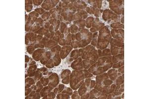 Immunohistochemical staining of human pancreas with SCFD1 polyclonal antibody  shows strong cytoplasmic positivity in exocrine glandular cells at 1:20-1:50 dilution. (SCFD1 antibody)