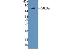 Detection of Recombinant antithrombin, Rat using Polyclonal Antibody to Antithrombin (AT) (SERPINC1 antibody  (AA 33-465))