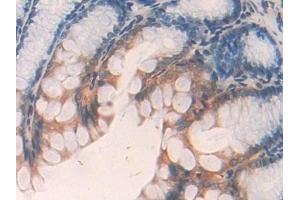 Detection of ANGPTL2 in Mouse Colon Tissue using Polyclonal Antibody to Angiopoietin Like Protein 2 (ANGPTL2) (ANGPTL2 antibody  (AA 267-493))