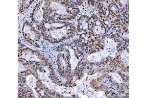 IHC analysis of MSH2 using anti-MSH2 antibody (ABIN7601369).