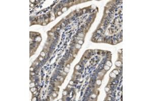IHC analysis of SAMHD1 using anti-SAMHD1 antibody (ABIN7601516). (SAMHD1 antibody  (AA 37-626))