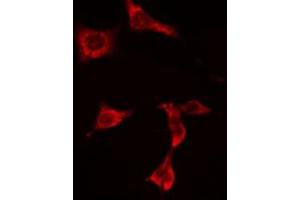 ABIN6274936 staining  HuvEc cells by IF/ICC. (PNPLA8 antibody  (C-Term))
