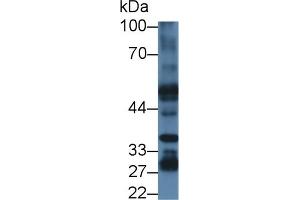 Detection of PSR in Mouse Liver lysate using Polyclonal Antibody to Phosphatidylserine Receptor (PSR) (JMJD6 antibody  (AA 1-334))