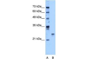 WB Suggested Anti-HMGB1 Antibody Titration:  1. (HMGB1 antibody  (Middle Region))