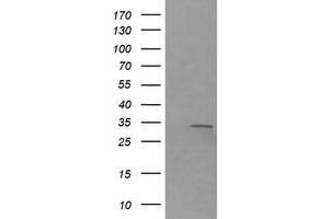 Image no. 1 for anti-Retinoic Acid Receptor Responder (Tazarotene Induced) 1 (RARRES1) antibody (ABIN1500602) (RARRES1 antibody)