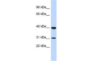 ZNF660 antibody used at 5 ug/ml to detect target protein. (ZNF660 antibody  (N-Term))