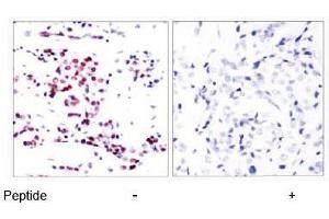 Image no. 1 for anti-Signal Transducer and Activator of Transcription 5A (STAT5A) (Ser780) antibody (ABIN197182) (STAT5A antibody  (Ser780))