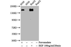 Western Blot Positive WB detected in A549 whole cell lysate 72epG2 whole cell lysate(treated with EGF or Pervanadate) All lanes Phospho-EGFR antibody at 1. (Recombinant EGFR antibody  (pTyr1068))