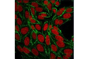 Confocal immunofluorescence image of HeLa cells using CD44 Mouse Monoclonal Antibody (156-3C11) Green (CF488) and Reddot is used to label the nuclei Red. (CD44 antibody)