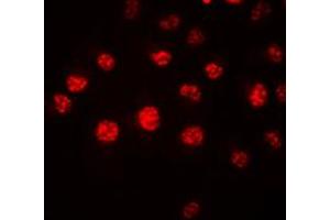 Immunofluorescent analysis of HOXA1 staining in HeLa cells. (HOXA1 antibody  (Center))