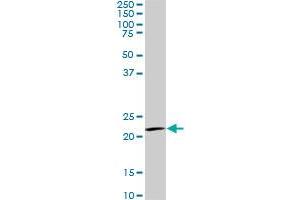 IL20 monoclonal antibody (M01), clone 2H8. (IL-20 antibody  (AA 67-176))