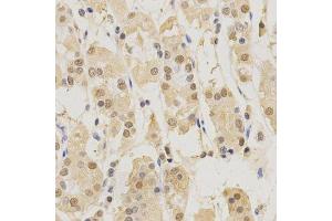Immunohistochemistry of paraffin-embedded human stomach using PSMB5 antibody.