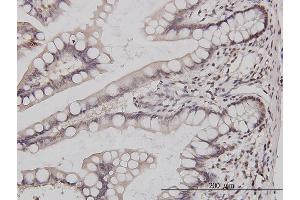 Immunoperoxidase of monoclonal antibody to GABPA on formalin-fixed paraffin-embedded human small Intestine. (GABPA antibody  (AA 1-100))