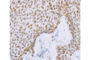 Immunohistochemistry (IHC) image for anti-Minichromosome Maintenance Complex Component 2 (MCM2) antibody (ABIN2428399) (MCM2 antibody)