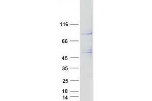 Validation with Western Blot (Presenilin 1 Protein (PSEN1) (Transcript Variant 1) (Myc-DYKDDDDK Tag))