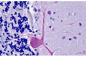 Human Brain, cerebellum: Formalin-Fixed, Paraffin-Embedded (FFPE) (OSBPL1A antibody  (AA 938-950))