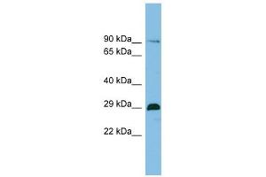 C1orf77 antibody used at 1 ug/ml to detect target protein.