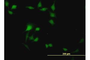 Immunofluorescence of monoclonal antibody to BOLL on HeLa cell. (BOLL antibody  (AA 80-176))
