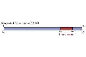 Image no. 2 for anti-SATB Homeobox 1 (SATB1) (AA 550-667) antibody (ABIN968403) (SATB1 antibody  (AA 550-667))