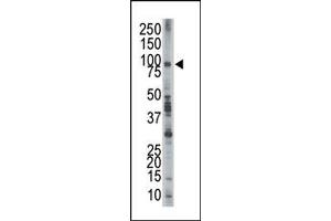 Image no. 1 for anti-Epidermal Growth Factor Receptor Pathway Substrate 8 (EPS8) (N-Term) antibody (ABIN360658) (EPS8 antibody  (N-Term))