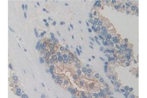 DAB staining on IHC-P; Samples: Human Prostate Tissue (GRK6 antibody  (AA 186-448))